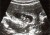 Our Baby